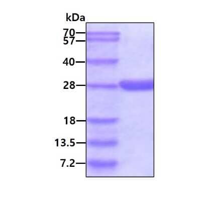 SDS-PAGE: Recombinant Human GSTA4 His Protein [NBP1-99022]